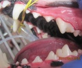 Снятие зубных отложений ультразвуковым скалером.